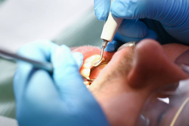 Best Emergency Treatment for Toothache in Lake Norman Of Catawba, NC